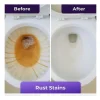 Toiletrens, Insta-Action Fizzclean Skum For Strålende Rent Toilet, Eliminerer Pletter På 20 Min, Skrubbefri Rengøring, Kraftfuld Dybderensning